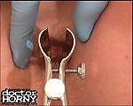 Med156